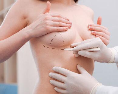 cirugía de mamas en clínica en Sabadell