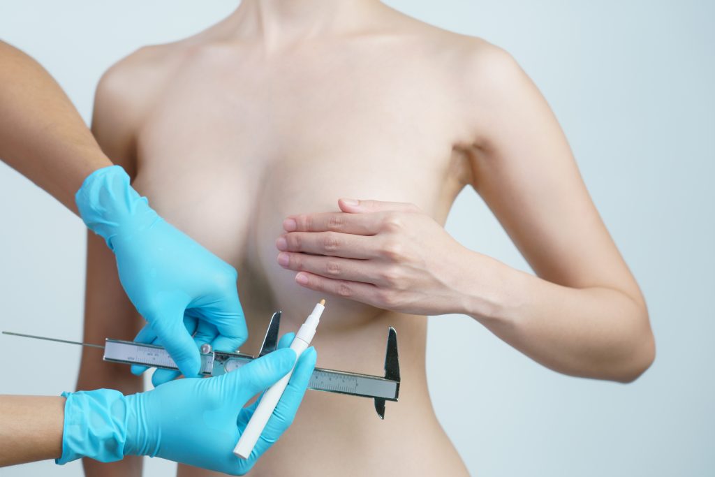 tomando medidas para el correcto implante de aumento de mamas 