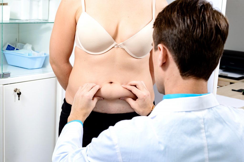 Médico preparando a mujer para la operación de la abdominoplastia